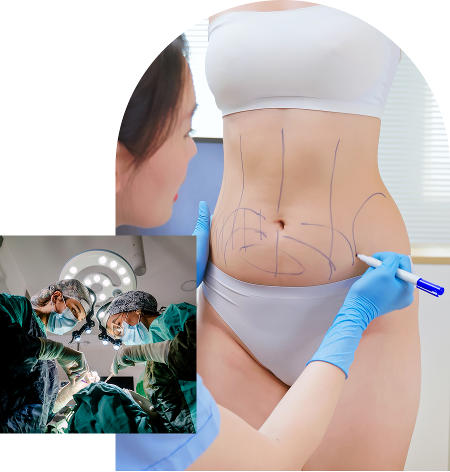 Plastic surgery preparation and procedure