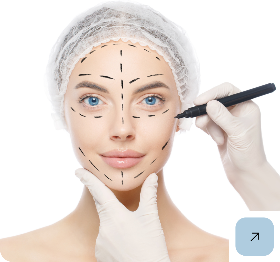 Woman's face with cosmetic surgery markings